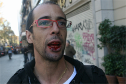 El fot�graf Jos� Col�n, ferit